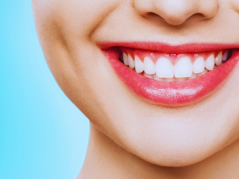 Close-up of a smiling woman with bright teeth and pink lipstick, showcasing results achievable with dentures.