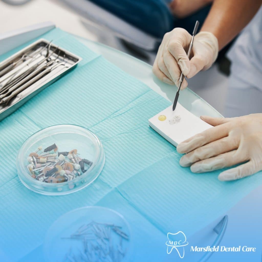 Dentist preparing dental fillings on a blue sanitary cloth with various dental tools scattered around.