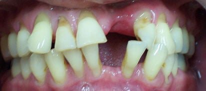 Before