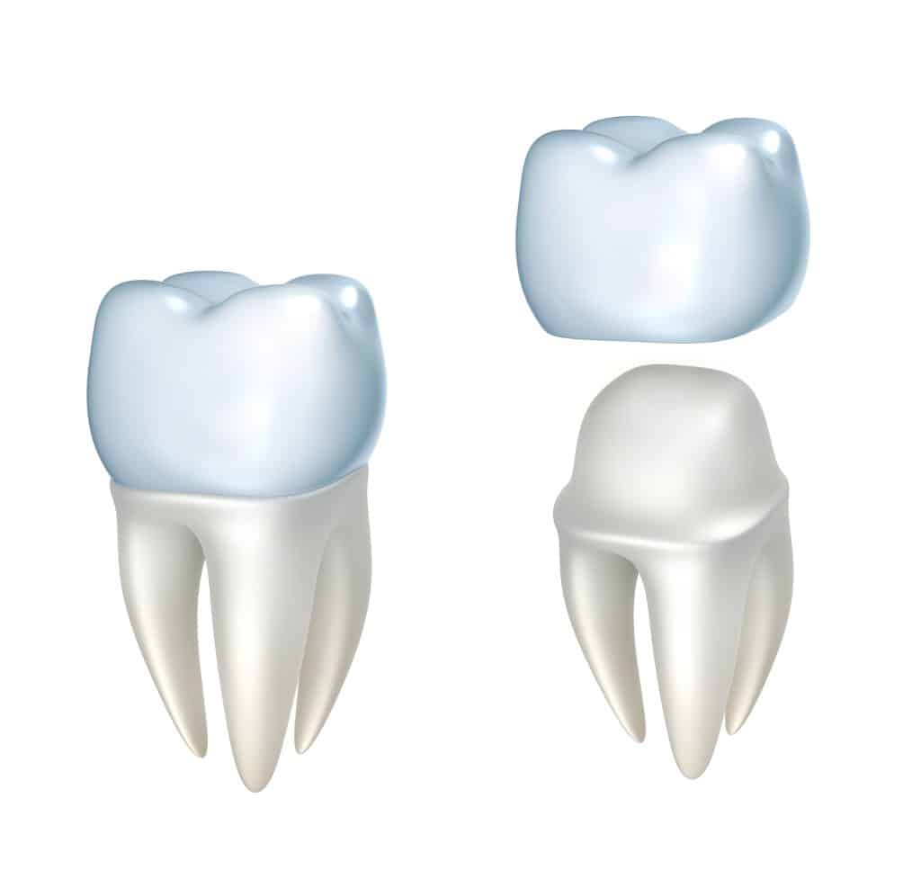 Dental crowns and tooth