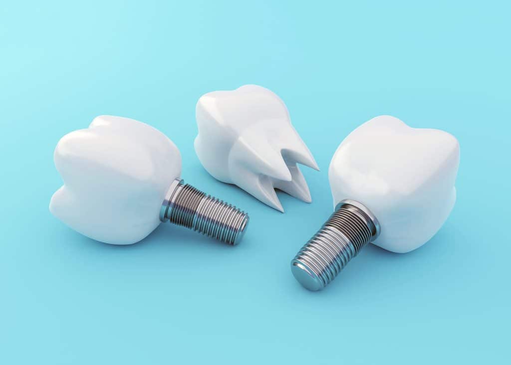 Artificial Tooth Implants and Tooth Crown on blue background|Artificial Tooth Implants and Tooth Crown on blue background