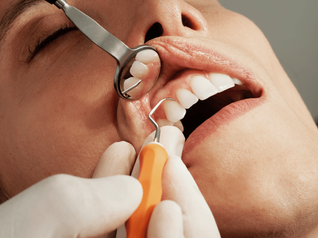Dental Crown Procedure