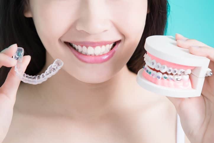 Teeth-Braces