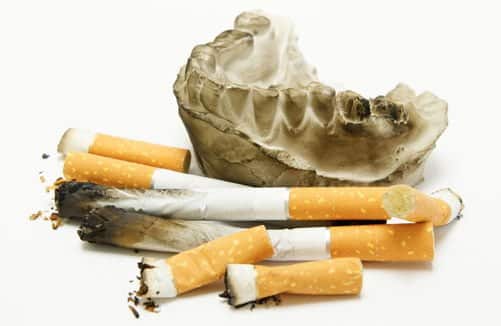 Effects of smoking on teeth