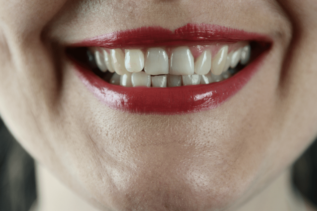 Gum Disease by Marsfield Dental Care|Understanding Gum Disease