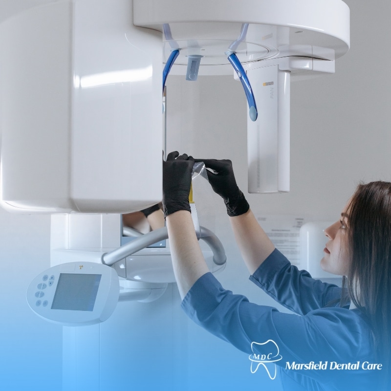 Dental X-ray machine being prepared by a dental technician wearing gloves at Marsfield Dental Care.