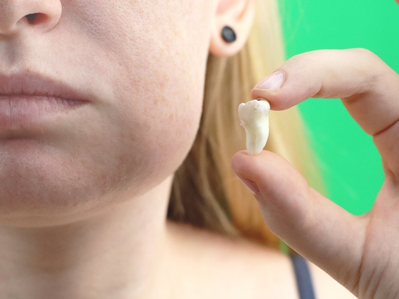 Close-up of a person's face and hand holding a tooth, possibly showing swelling after dental extraction.