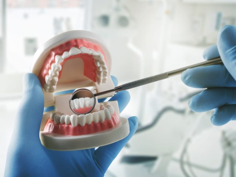 Dentist using dental model to explain dental crown longevity.