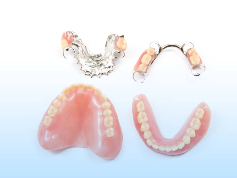 Partial Dentures including upper, lower, and metal-frame types on display